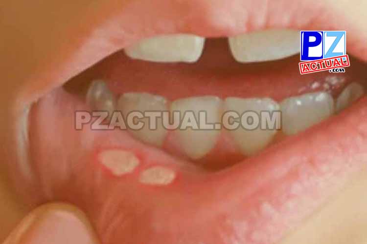 Salud oral, www.pzactual.com