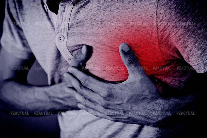 Ataque al corazón PZ Actual